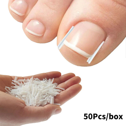50Pcs Ingrown Toenail Correction - Improve Center