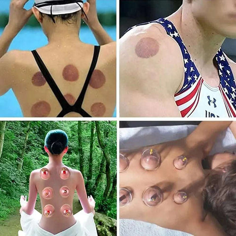 Vacuum Cupping Set - Improve Center