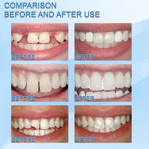 Tooth Repair Gel