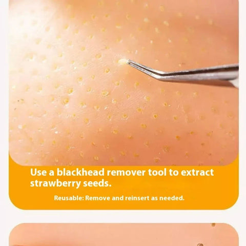 Squeeze Blackhead Toy – Relaxing Acne Simulation for Stress Relief