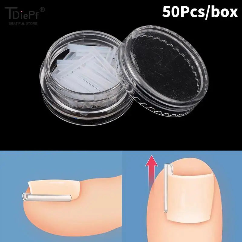 50Pcs Ingrown Toenail Correction