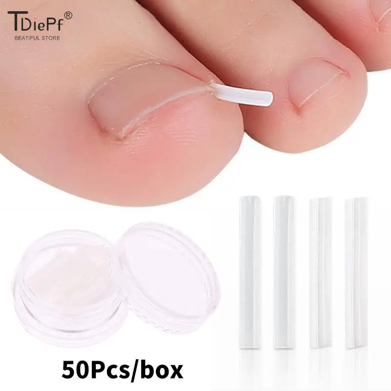 50Pcs Ingrown Toenail Correction