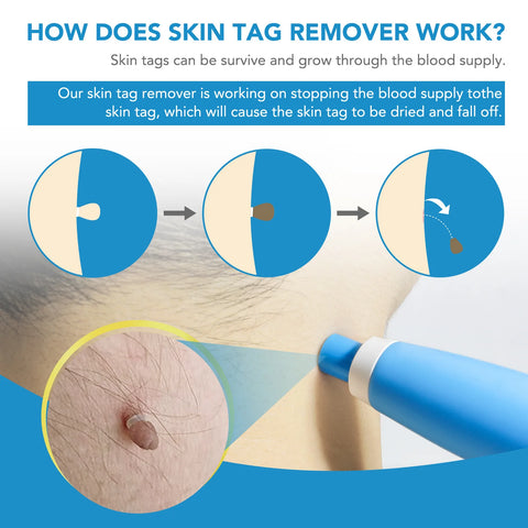 ClearSkin TagAway - Improve Center