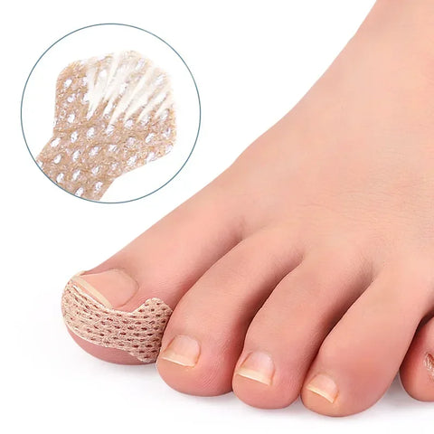 Toenail Correction Stickers – Painless Ingrown Nail Care Strips