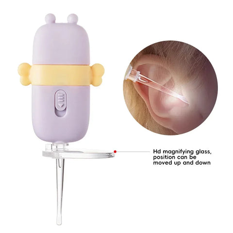 Earwax Baby Removal - Improve Center