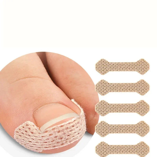 Toenail Correction Stickers – Painless Ingrown Nail Care Strips