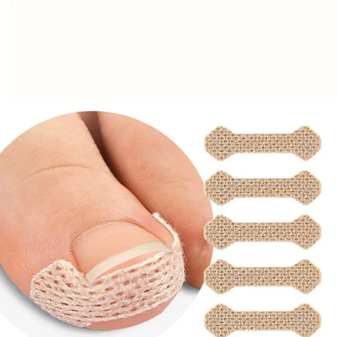 Toenail Correction Stickers – Painless Ingrown Nail Care Strips